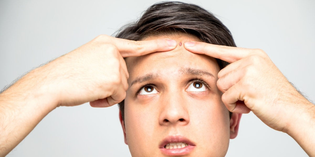 10 Ways to Prevent Acne