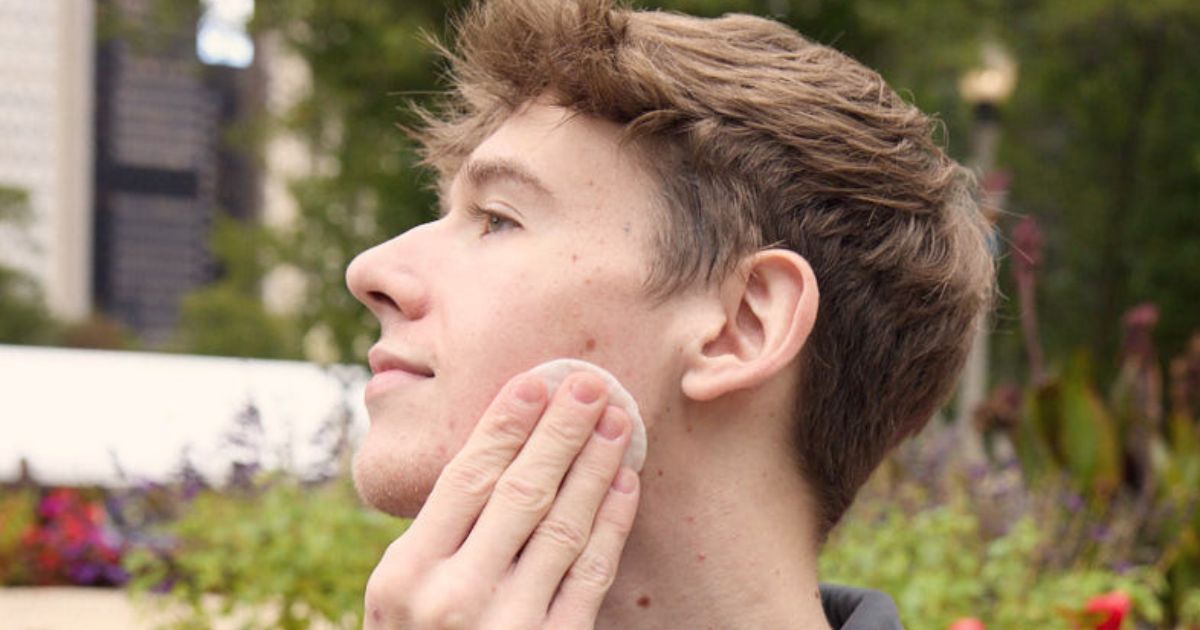How to Help Your Teenage Son Clear His Acne: A Simple Guide for Moms