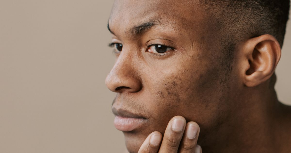 Skin Care for Black Men: How to Fade Dark Spots, Beat Razor Bumps, and Even Your Skin Tone (2026)