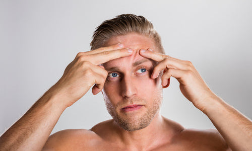 man squeezing pimple
