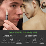 Advanced Blemish Fighting Bundle