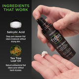Acne Serum 30 day supply